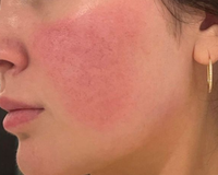 abloom-sets-rosacea-set-gesichtspflegeset-3-teilig-beruhigung image 2